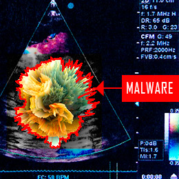 Novared - Checkpoint - Ultrasound Malware