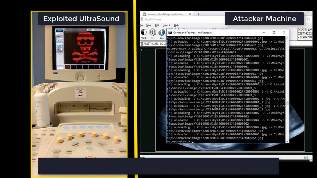 UltraHack - The Security Risks of Medical -IoT